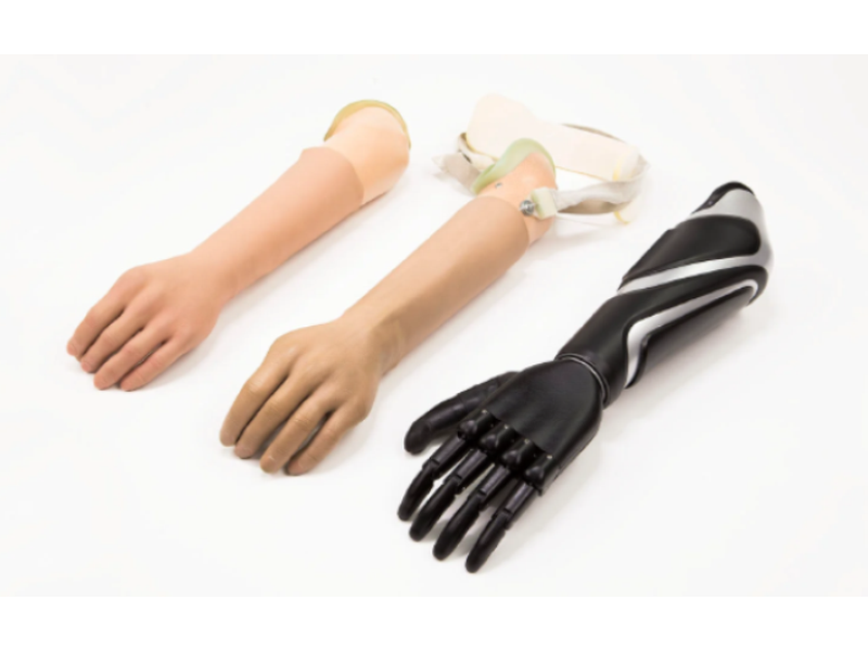 Upper Extremity Prosthetics Manufacturers in India